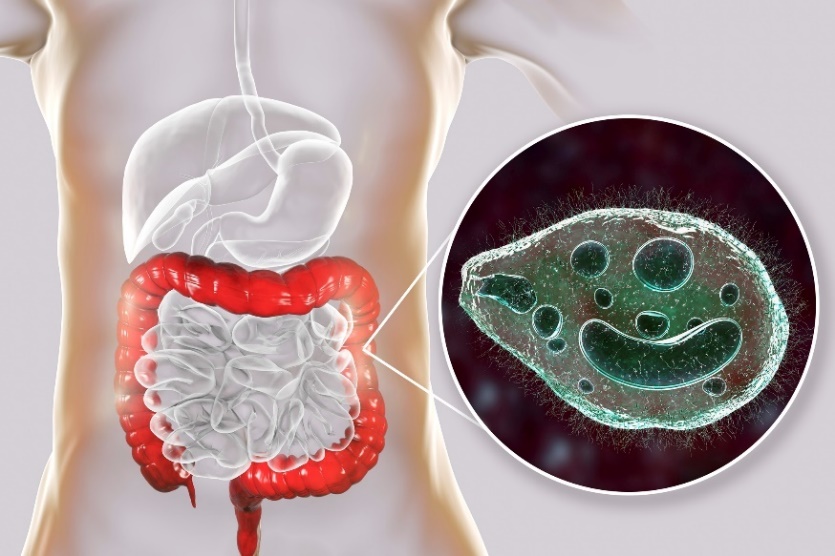 Balantidium coli - insan sindirim sisteminin kalın bağırsağını enfekte eden bir parazit