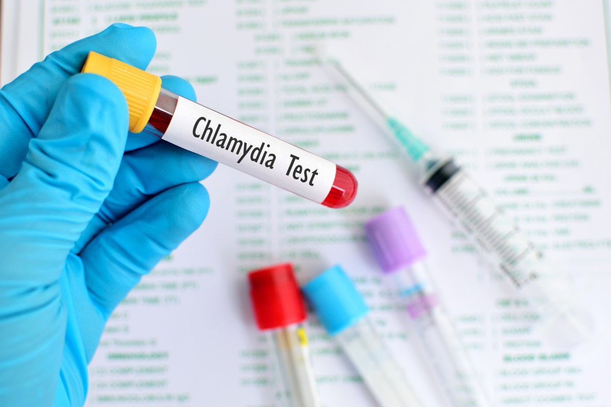 Chlamydia testi - test tüpünde kan, test tüpünü tutan eldivenli el, arka planda test tüpü, iğne