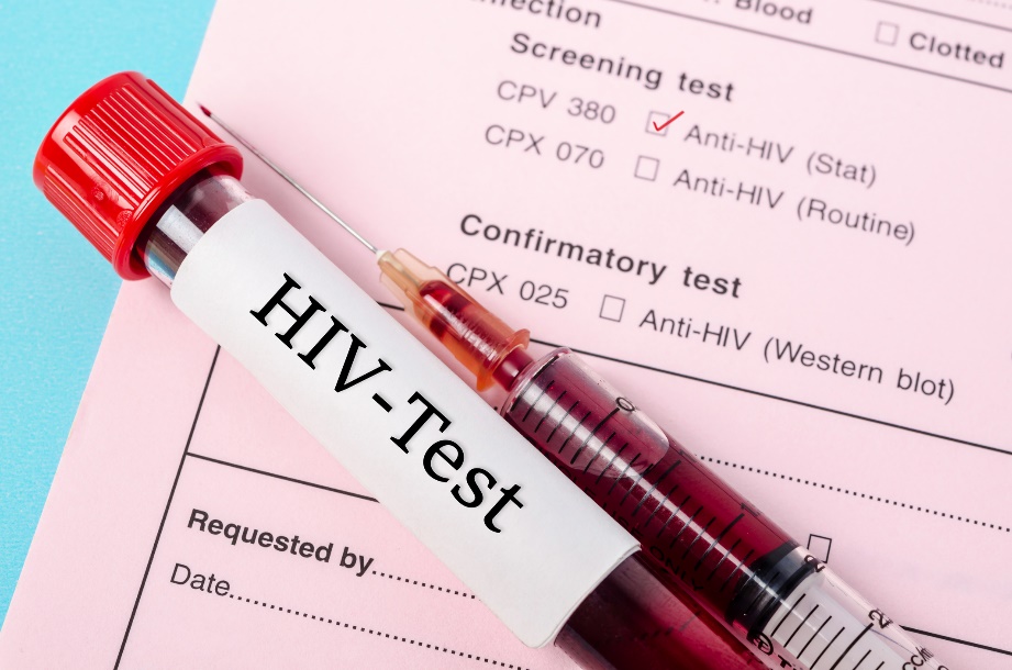 Bir hastanın kan örneğinde anti-HIV antikorlarının varlığına yönelik tanı testi