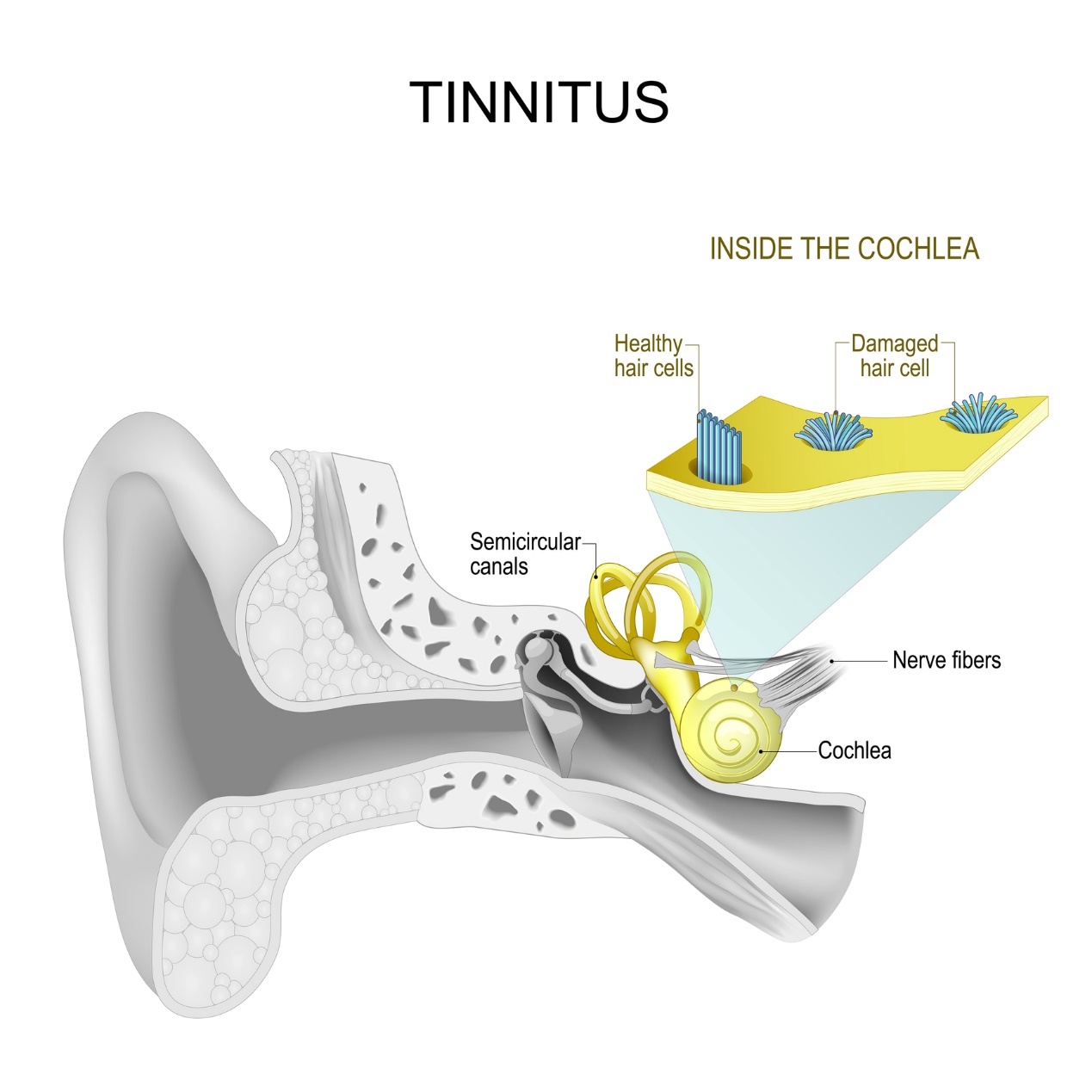 İç kulak ve tinnitus - kulakta ıslık ve uğultu