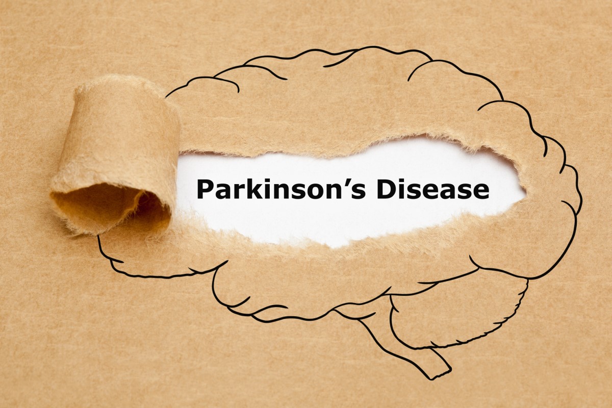 Morbus parkinson = Parkinson hastalığı = Parkinson hastalığı - ortasında Parkinson hastalığı olan bir beyin animasyonu