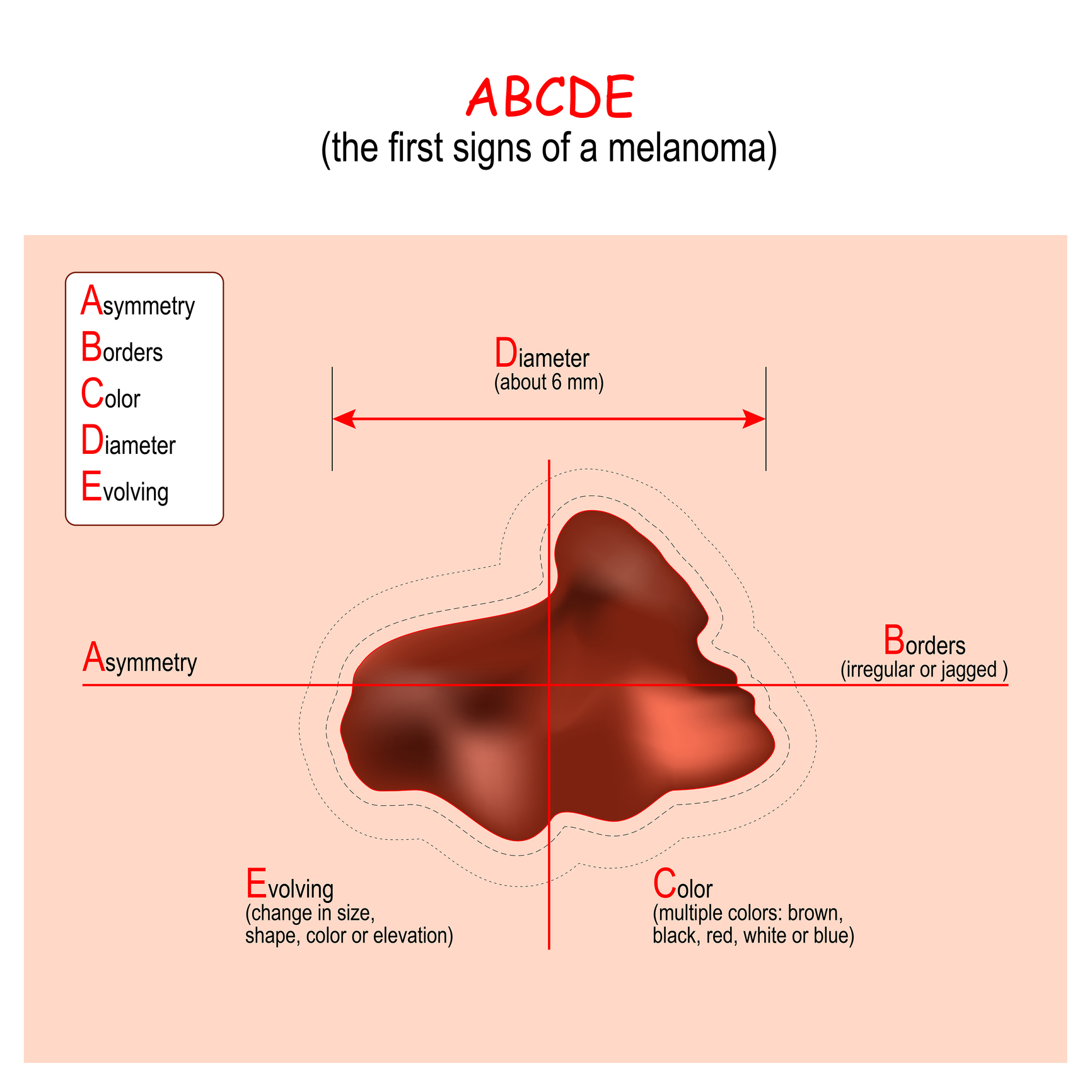 ABCDE algoritması