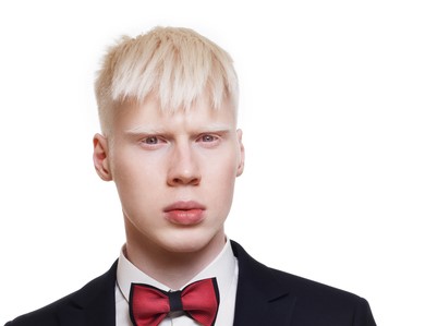 genç albino erkek, beyaz saçlı, ceket giyiyor