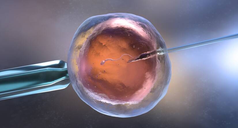 In vitro fertilizasyon IVF. Kaynak: Getty Images