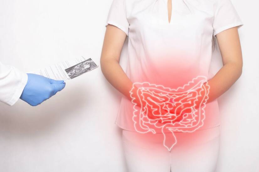 Crohn hastalığı: nedir, neden ortaya çıkar ve belirtileri nelerdir?