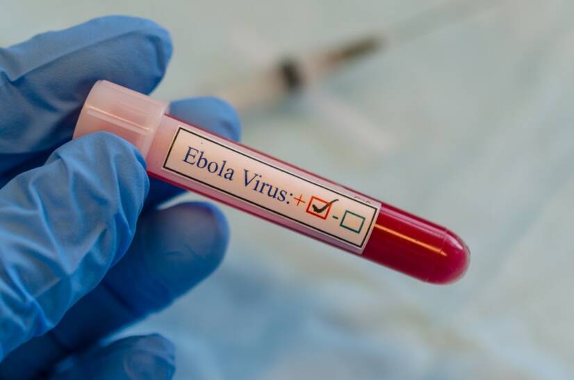 Ebola: Belirtileri nelerdir?