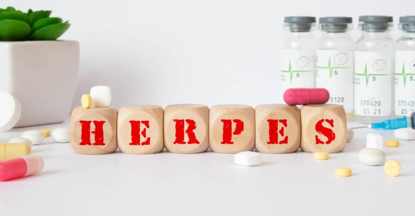 Genital herpes: nasıl görünür ve hangi belirtileri vardır? Önleme yöntemi