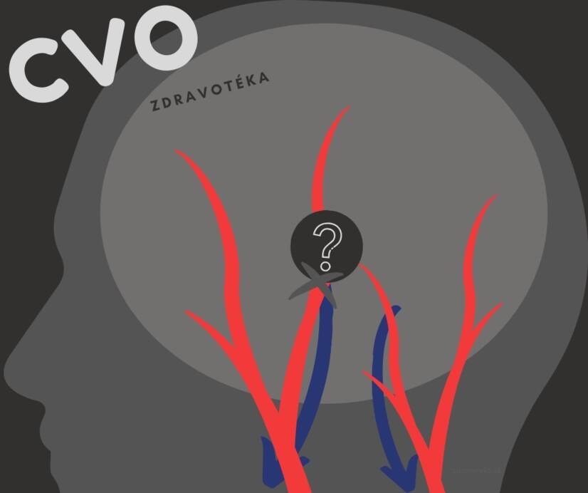 Serebrovasküler hastalık: zayıflamış, daralmış veya genişlemiş serebral kan damarları? Nedenlerini ve semptomlarını öğrenin