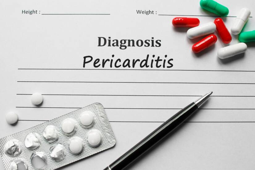 Perikardit: Kalp zarının iltihaplanması, nedenleri ve belirtileri nelerdir?