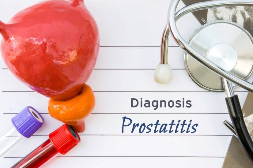 Prostat iltihabı (prostatit): nedenleri ve belirtileri nelerdir?