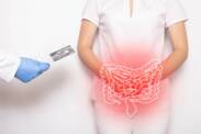 Crohn hastalığı: nedir, neden ortaya çıkar ve belirtileri nelerdir?