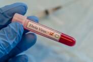 Ebola: Belirtileri nelerdir?